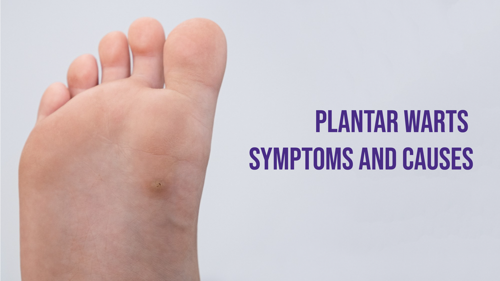 Plantar warts - Symptoms and Causes